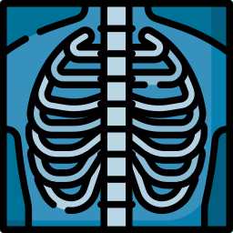 X-Ray